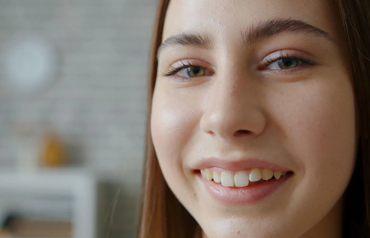 Close-up of a smile, before treatment